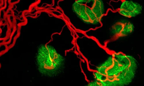 Rare diseases