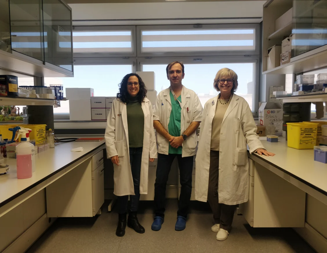 Una investigación liderada desde Lleida identifica un potencial biomarcador del comportamiento de los melanomas