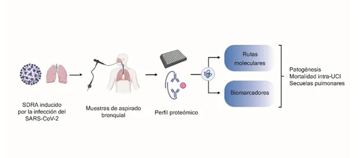 Demostren que el SARS-CoV-2 indueix alteracions en el perfil proteòmic de l'aspirat bronquial del pacient crític