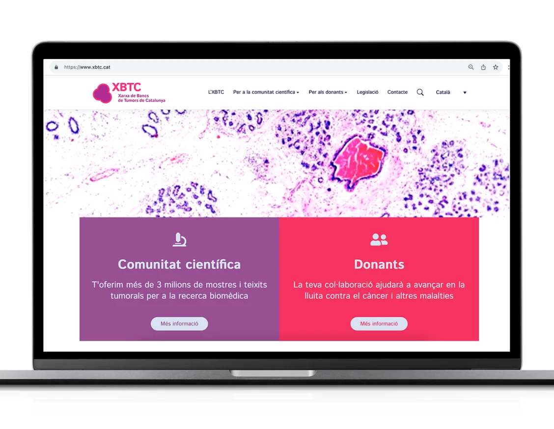 The Catalan Tumour Bank Network launches a new corporate identity and website